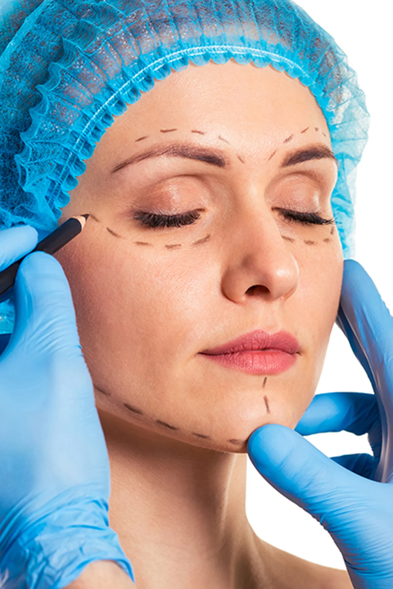 Rinoplastia Ultrasónica en Cuenca, Rinoplastia Ultrasónica Cuenca,